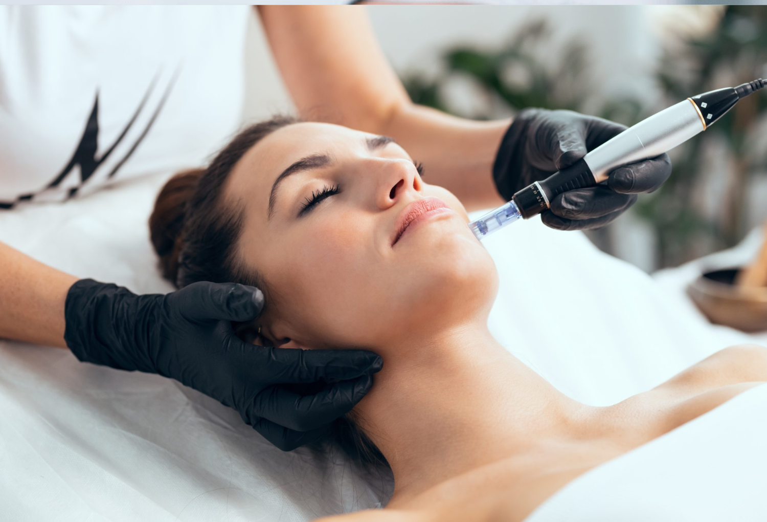 Microneedling & PRP